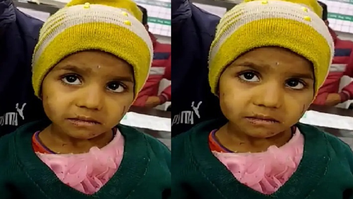 सहारनपुर: कलयुगी मां ने 5 साल की बच्ची को नाखूनों से नोंचा, फिर पैरों पर मारे डंडे, मासूम के चेहरे पर दिखे जुल्म के निशान
